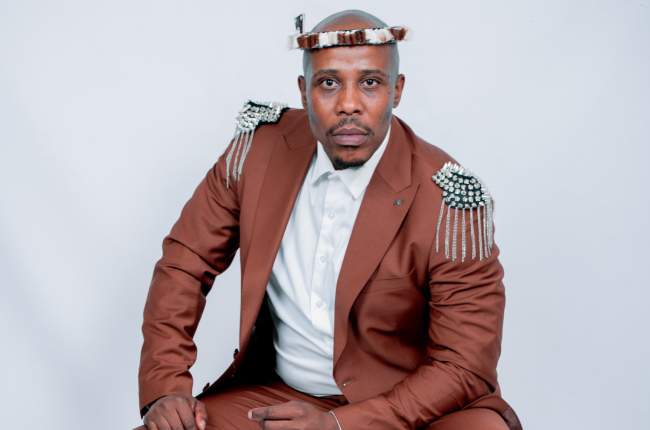 ‘Generation: The Legacy’ Actor Mondli Thusi Survives Pitbull Attack